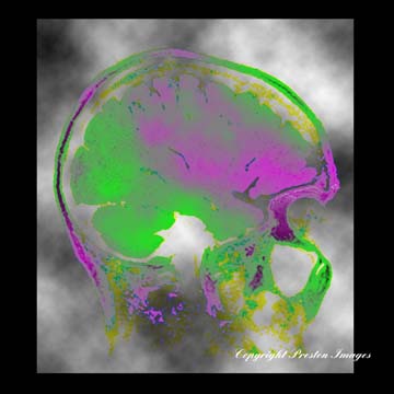 abstract art gallery image